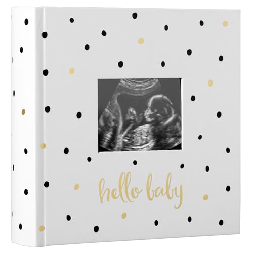 Pearhead Hello Baby Photo Album, Keepsake Book for New and Expecting Parents, Gender-Neutral Baby Accessory, Ideal Gift for Baby Shower, Holds 200 Pictures, Black and Gold Polka Dot | Holds 200 4x6" Pictures with Space for Notes, Memory Keepsake Book for