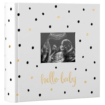 Pearhead Hello Baby Photo Album, Keepsake Book for New and Expecting Parents, Gender-Neutral Baby Accessory, Ideal Gift for Baby Shower, Holds 200 Pictures, Black and Gold Polka Dot | Holds 200 4x6" Pictures with Space for Notes, Memory Keepsake Book for